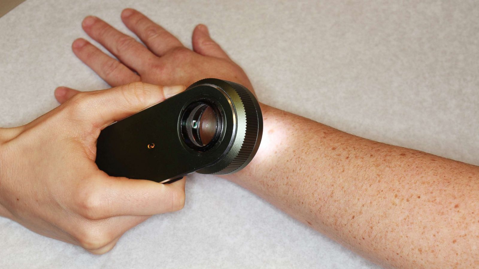 DermSense Mapping